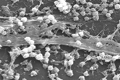 biofilm catheter